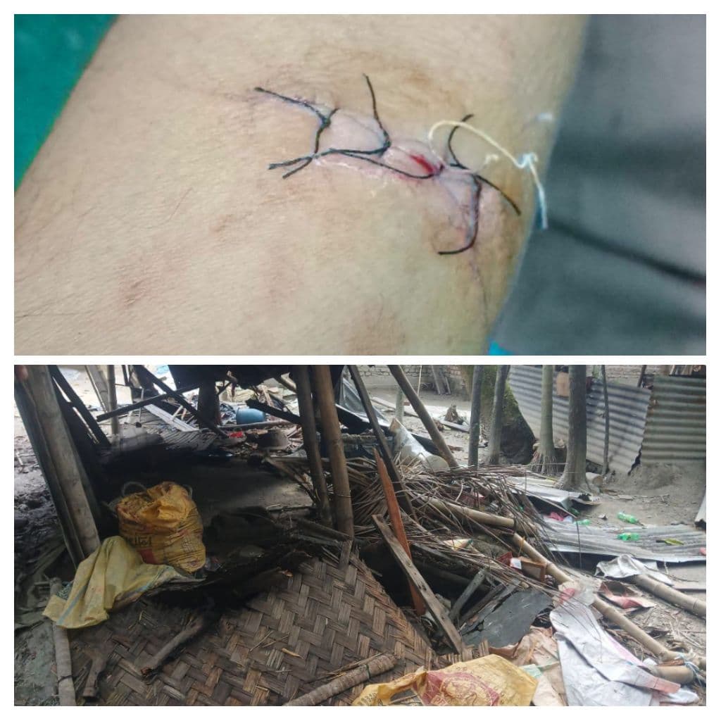 বেগমগঞ্জের ছয়ানীতে বসতবাড়িতে হামলা ভাঙচুর লুটপাট আহত- ৩